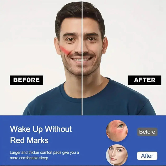 Comfort CPAP Mask Cover with Face Cushion Pads - 6pcs - Next day Delivery CPAP Mask Cushion Pads SelfiMed UK