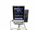 Edan iM3 Patient Monitor with NIBP & SPO2 patient monitor SelfiMed UK