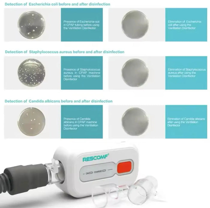Portable Ozone CPAP Cleaner device model XD100 for disinfecting CPAP mask and tubes cpap masks SelfiMed UK